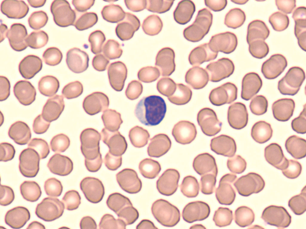 Large Lymphocyte