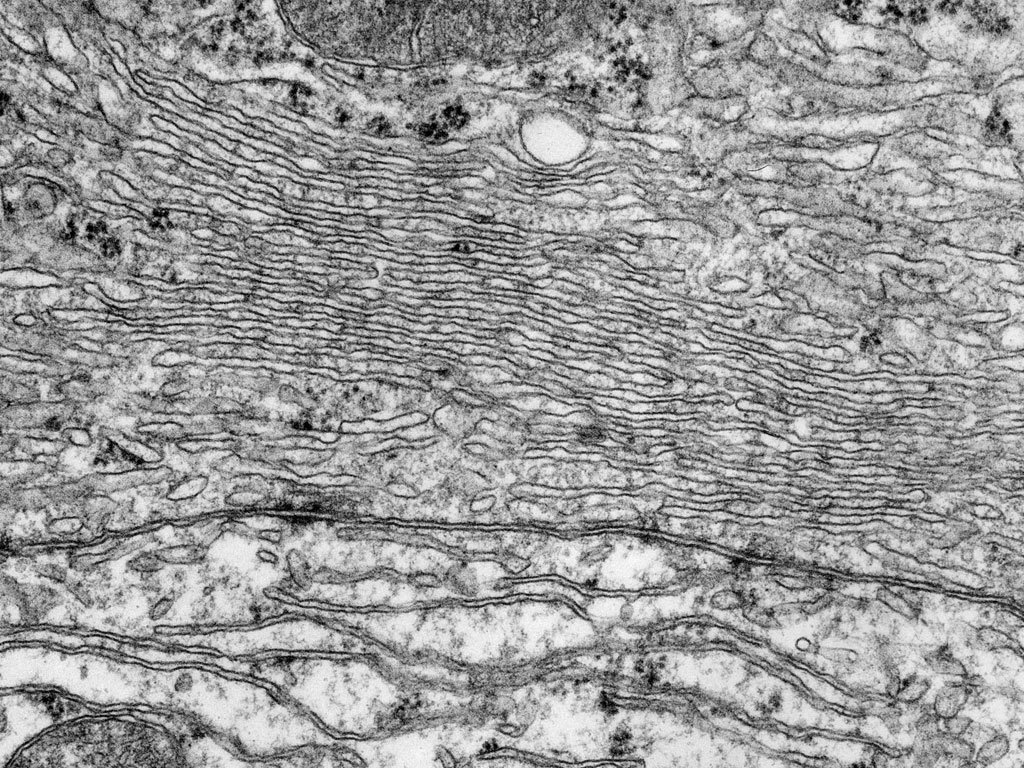 smooth-endoplasmic-reticulum-em