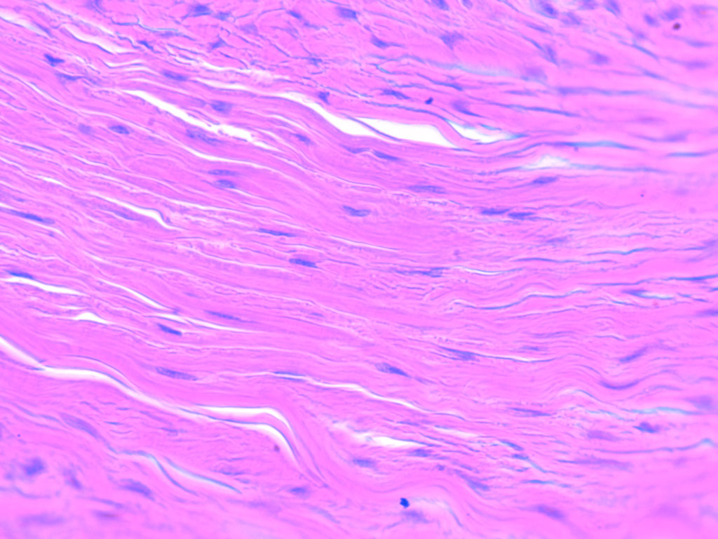 connective tissue labeled