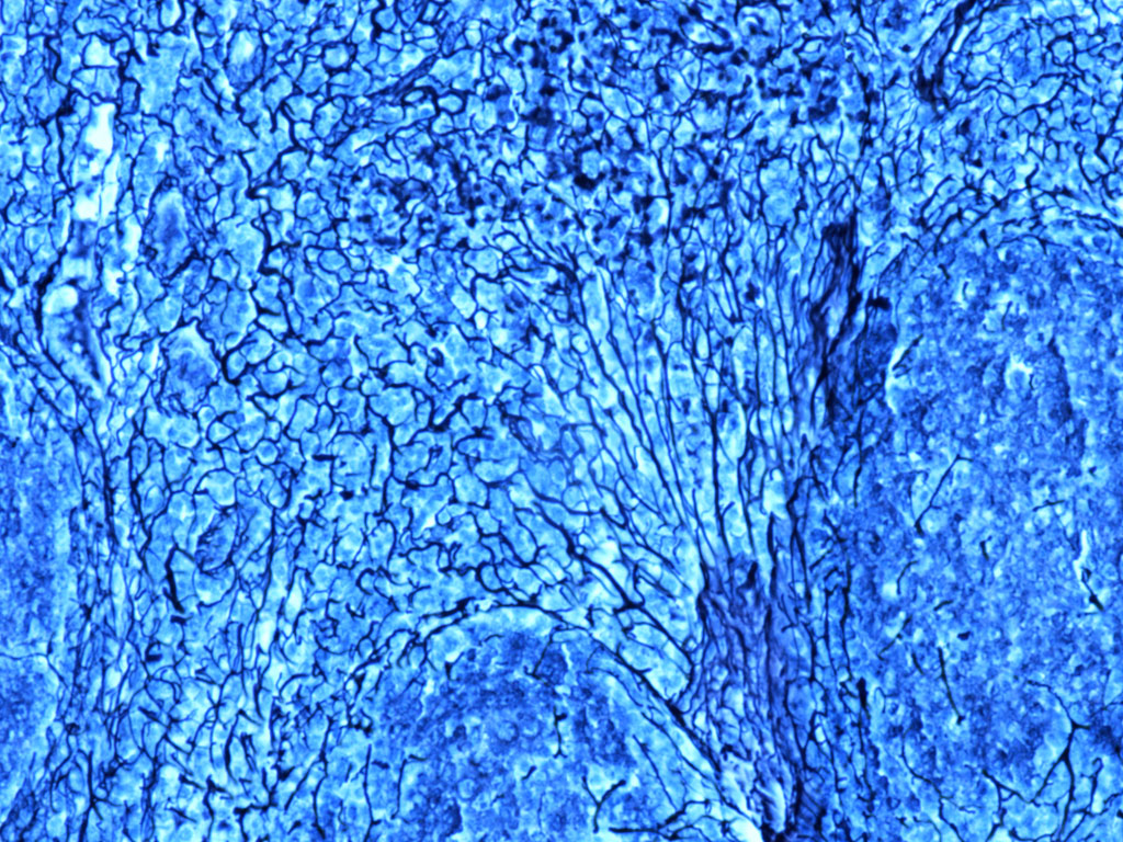 Reticular Fibers