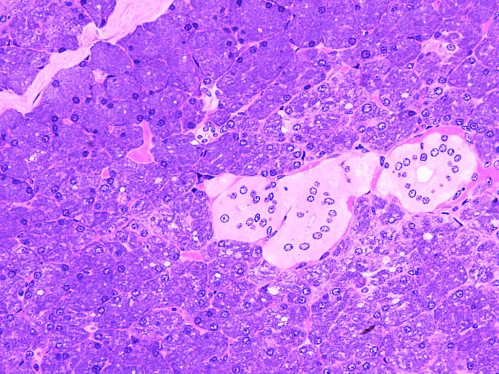 parotid-gland