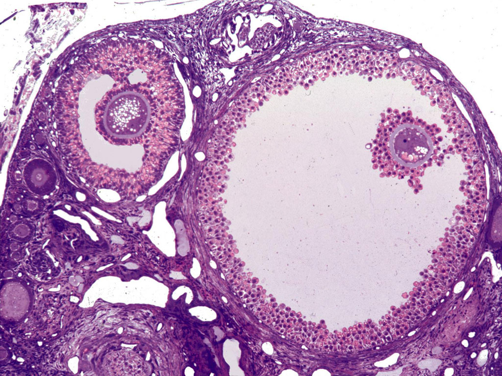 What Is Meant By Dominant Follicle