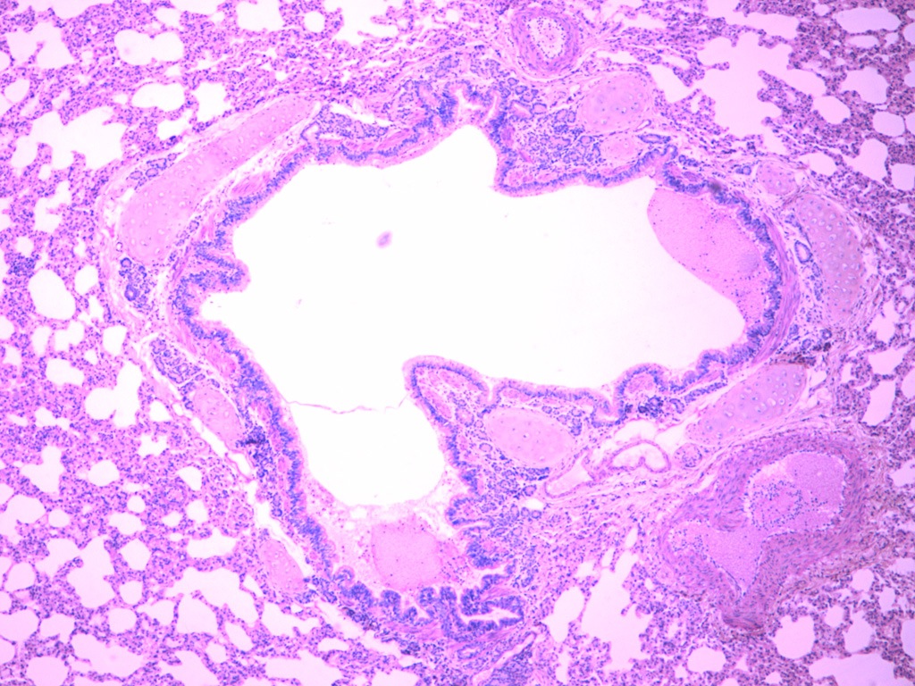 bronchus slide labelled