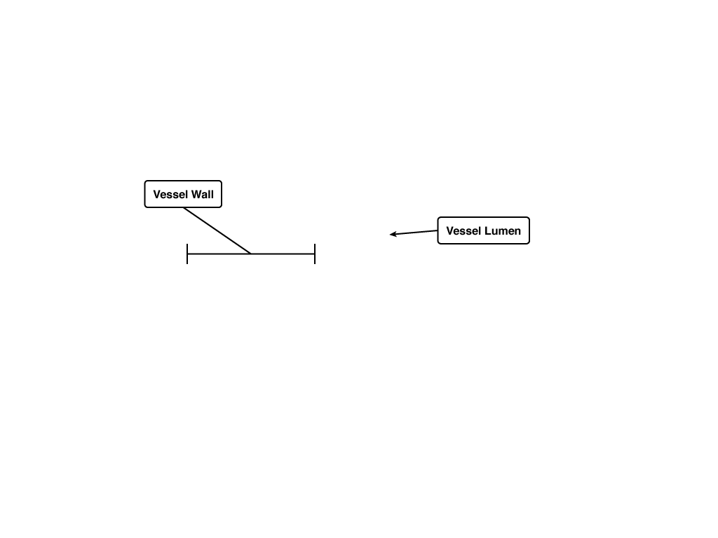 pulmonary-hypertension