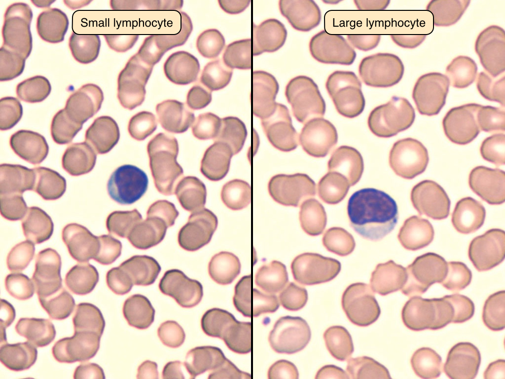 blood-lab