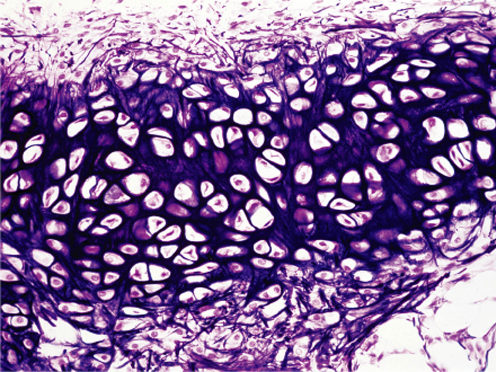 Elastic Cartilage