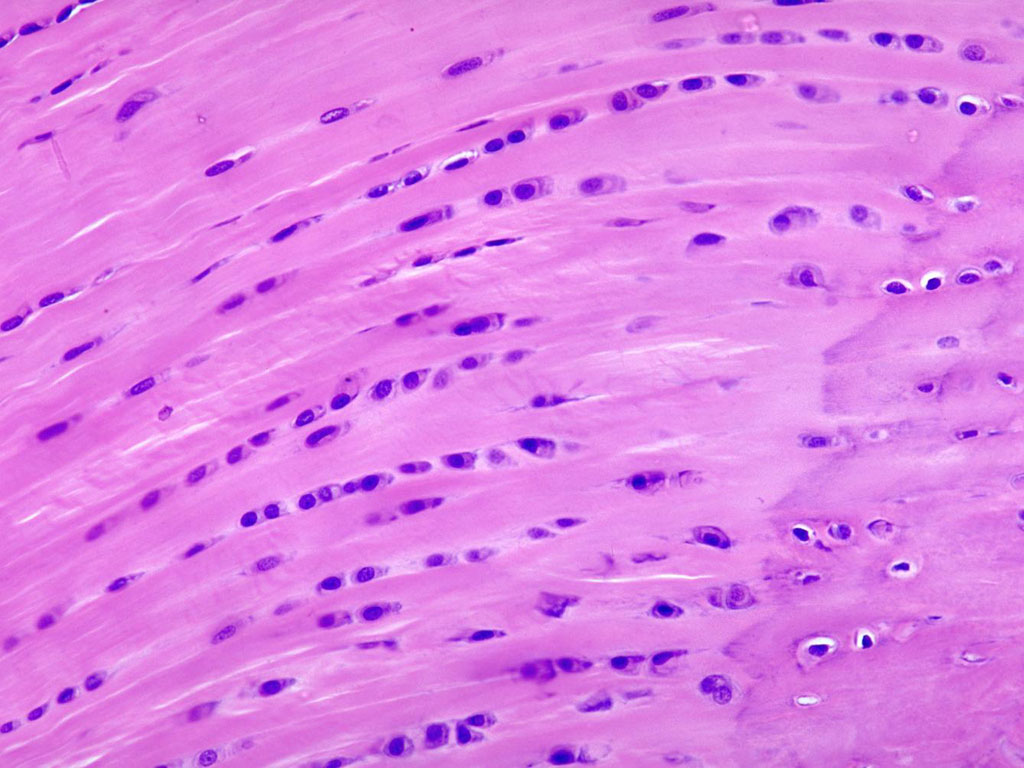 Fibrocartilage