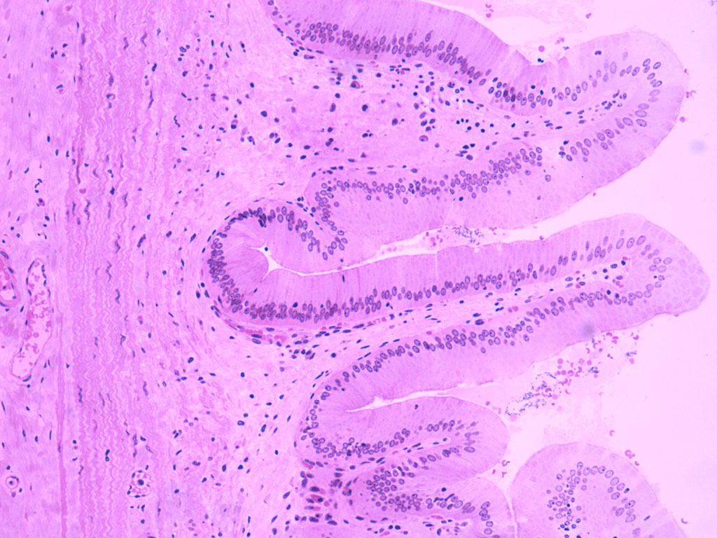 gallbladder histology labeled