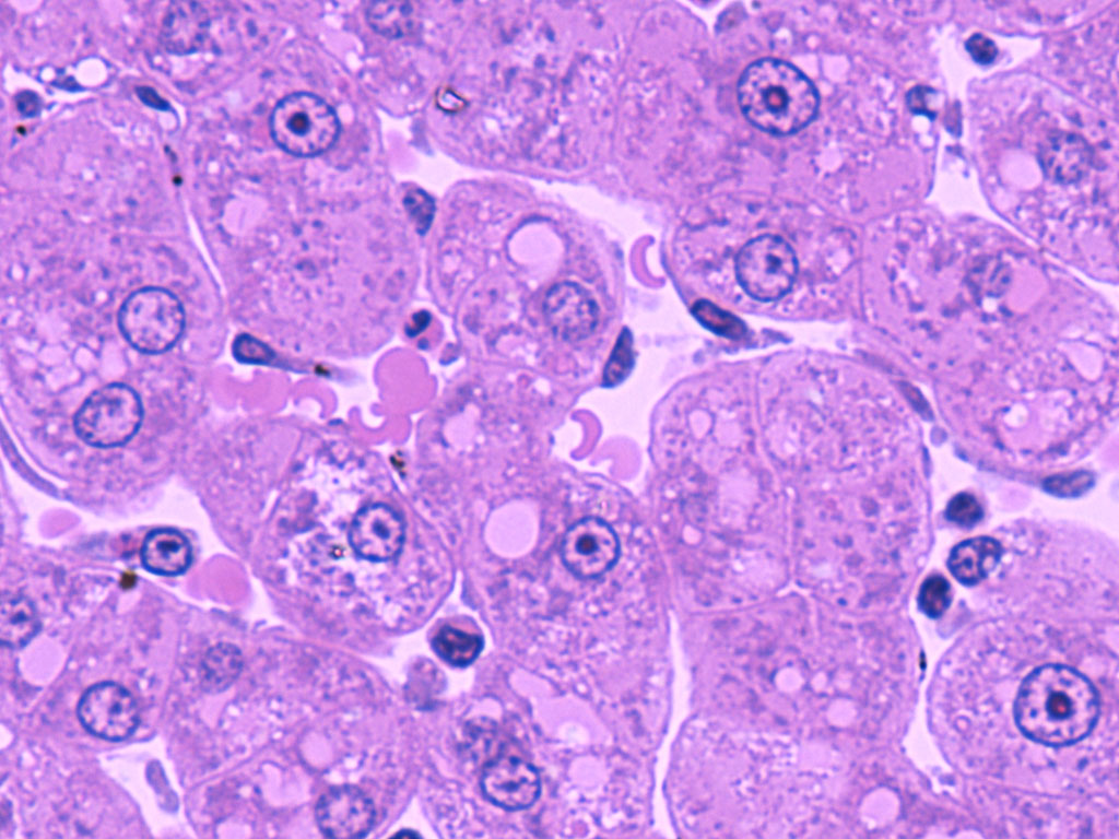 hepatocyte histology