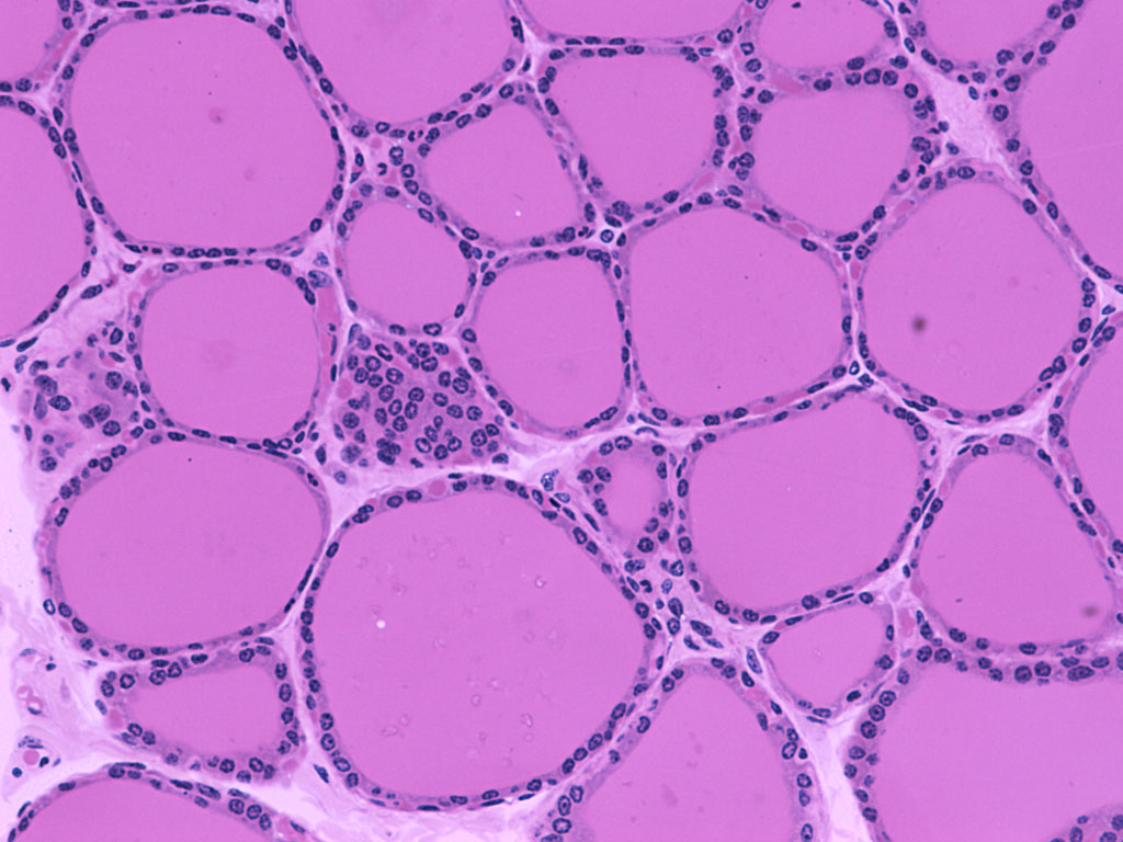 normal thyroid histology