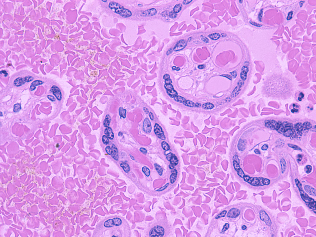 chorionic villi histology