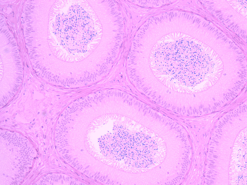 epididymis histology