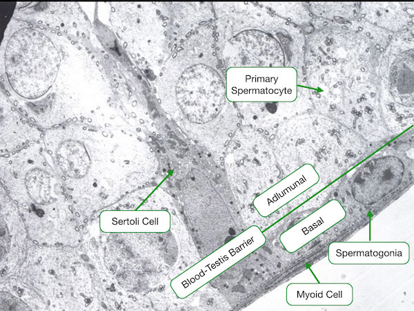 sertoli cells