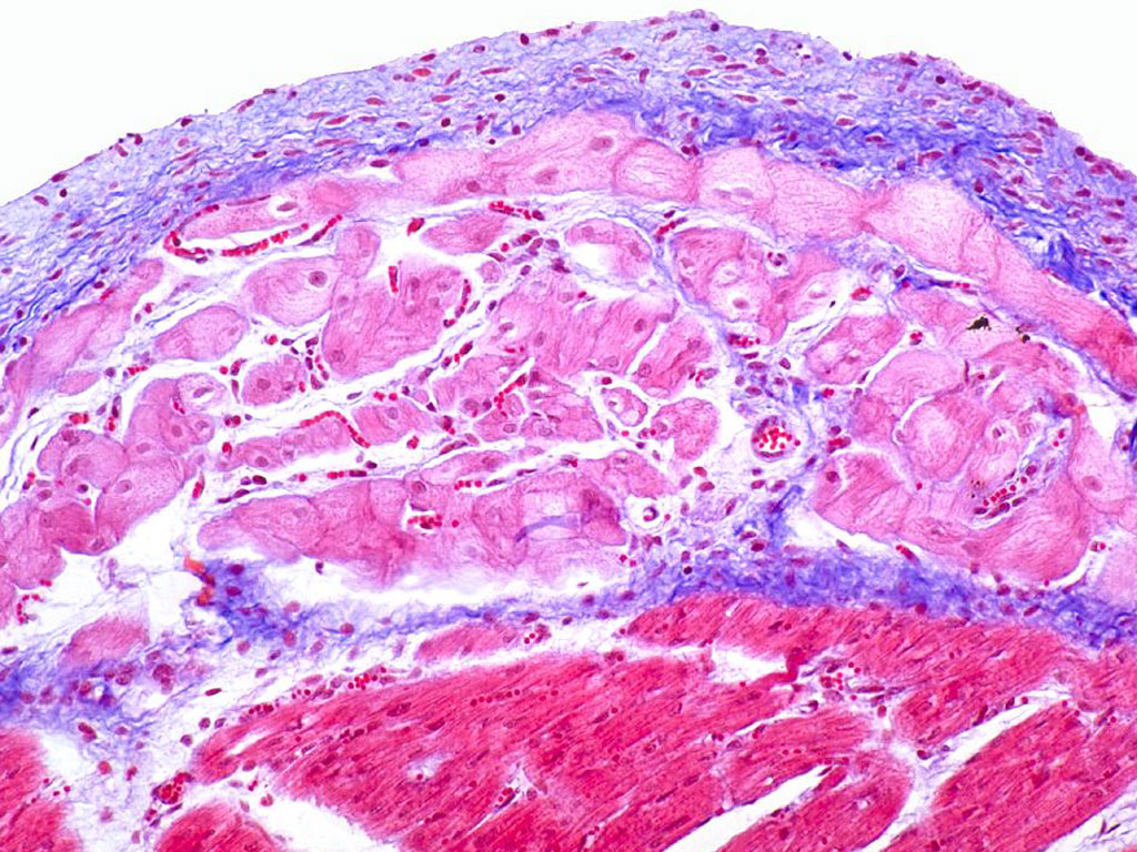 purkinje fibers histology