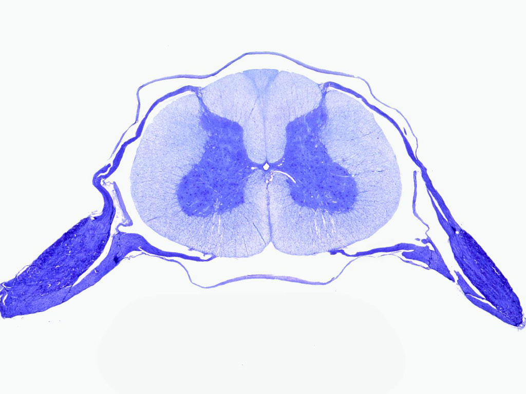 MED 612: Spinal Cord Laminae & Histology