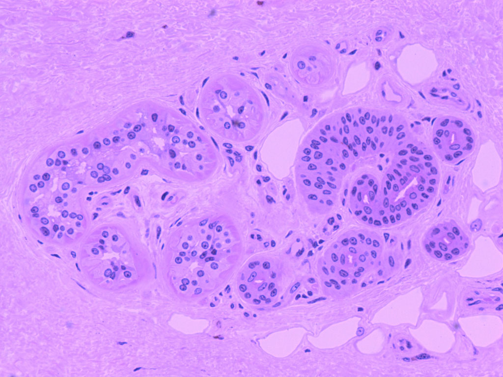 sebaceous glands histology