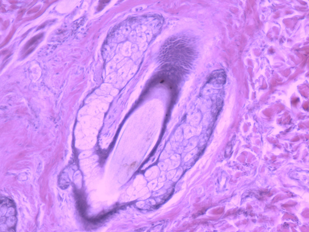 sebaceous glands histology