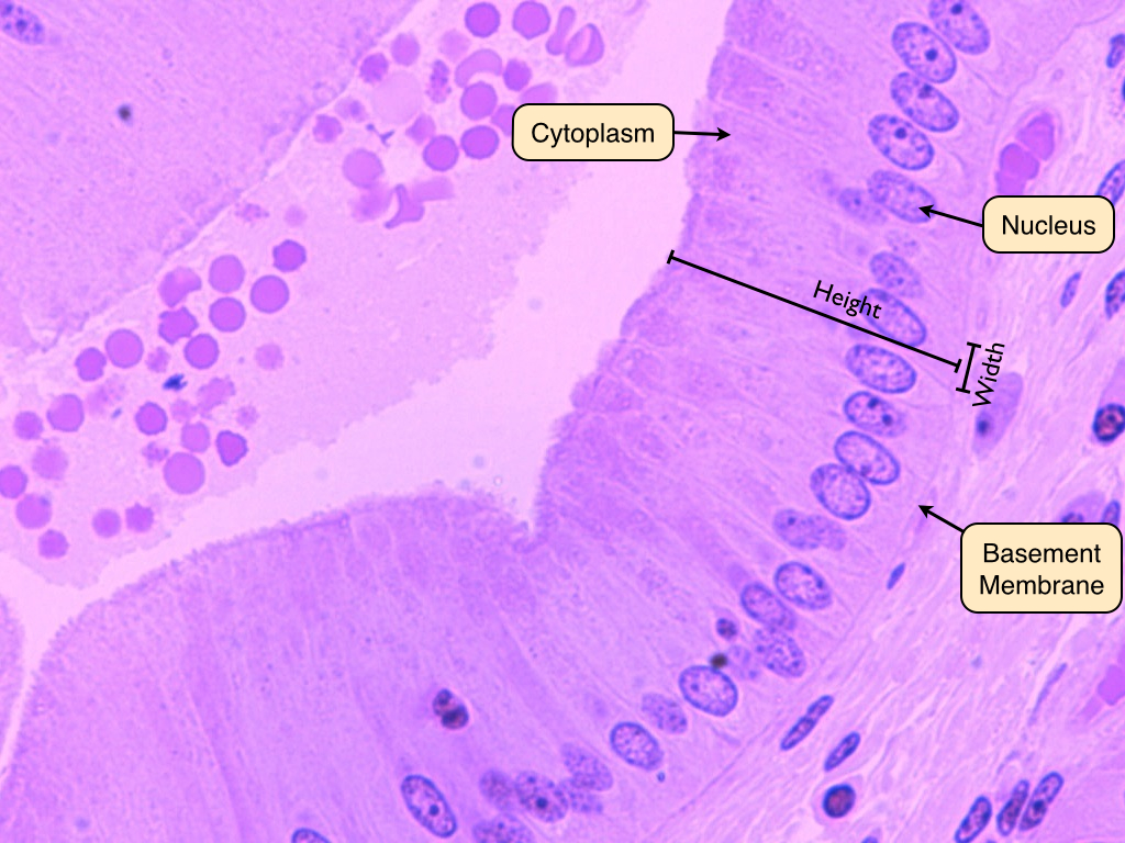 Tissues Histology Photos Epithelial Tissue Simple Simple Columnar 