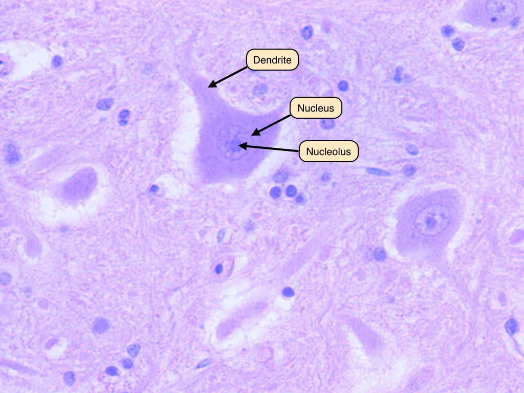 multipolar neuron labeled under microscope